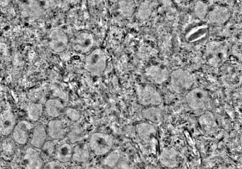 Ptychographic phase image of a 60nm thick slice of mouse brain tissue. Sample courtesy of Andreas Schaefer.