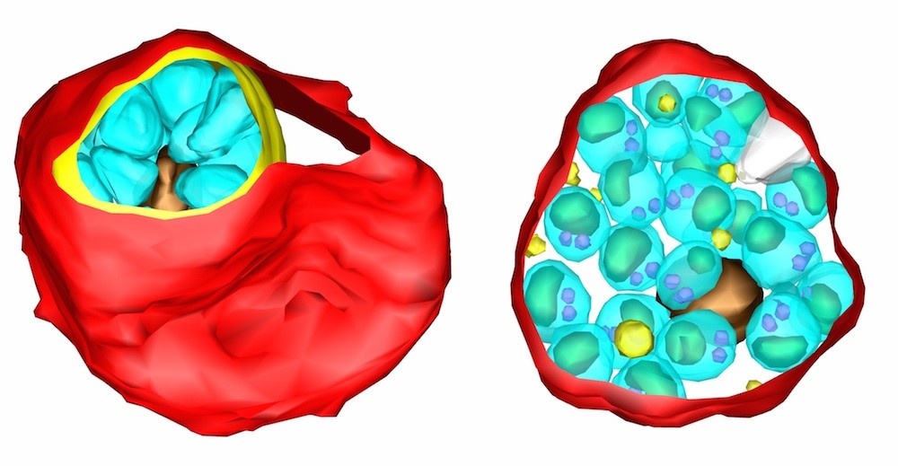 Malaria parasites inside red blood cells, showing the way they emerge from the cell. 
<br/>Left: the parasites (blue) are wrapped in their own membrane coat (yellow). 
<br/>Right: after breaking out of their membrane compartment, but before breaking out of the red blood cell. 
<br/>
<br/>
<br/>