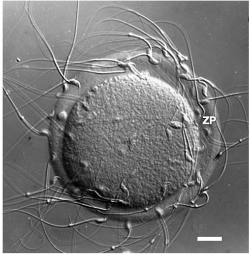 Photographic image of a light micrograph (Nomarski differential interference contrast) of an unfertilised mouse egg incubated in the presence of free-swimming sperm.<br/>Sperm are shown bound to the zona pellucida. Scale bar = ≃14 µm.