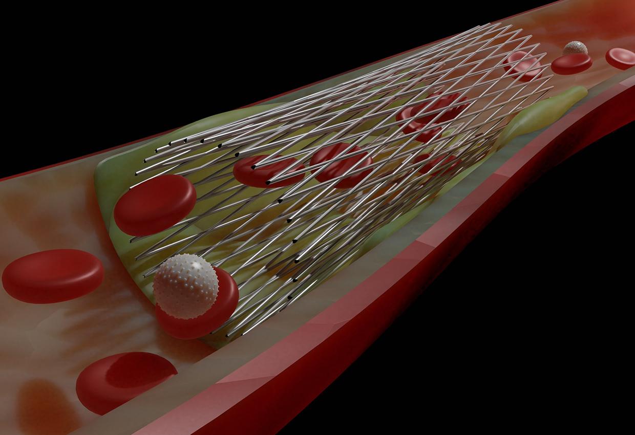PLLA-stents