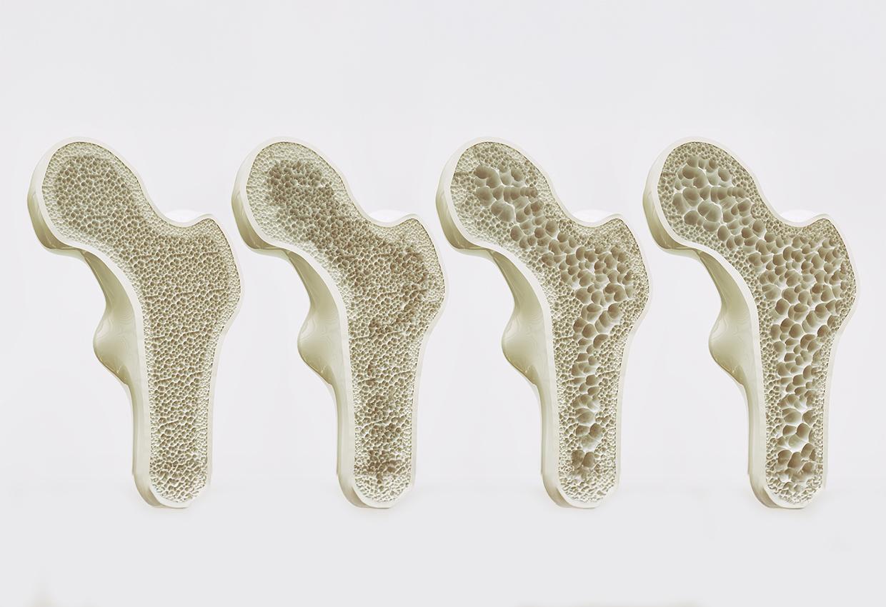 bones