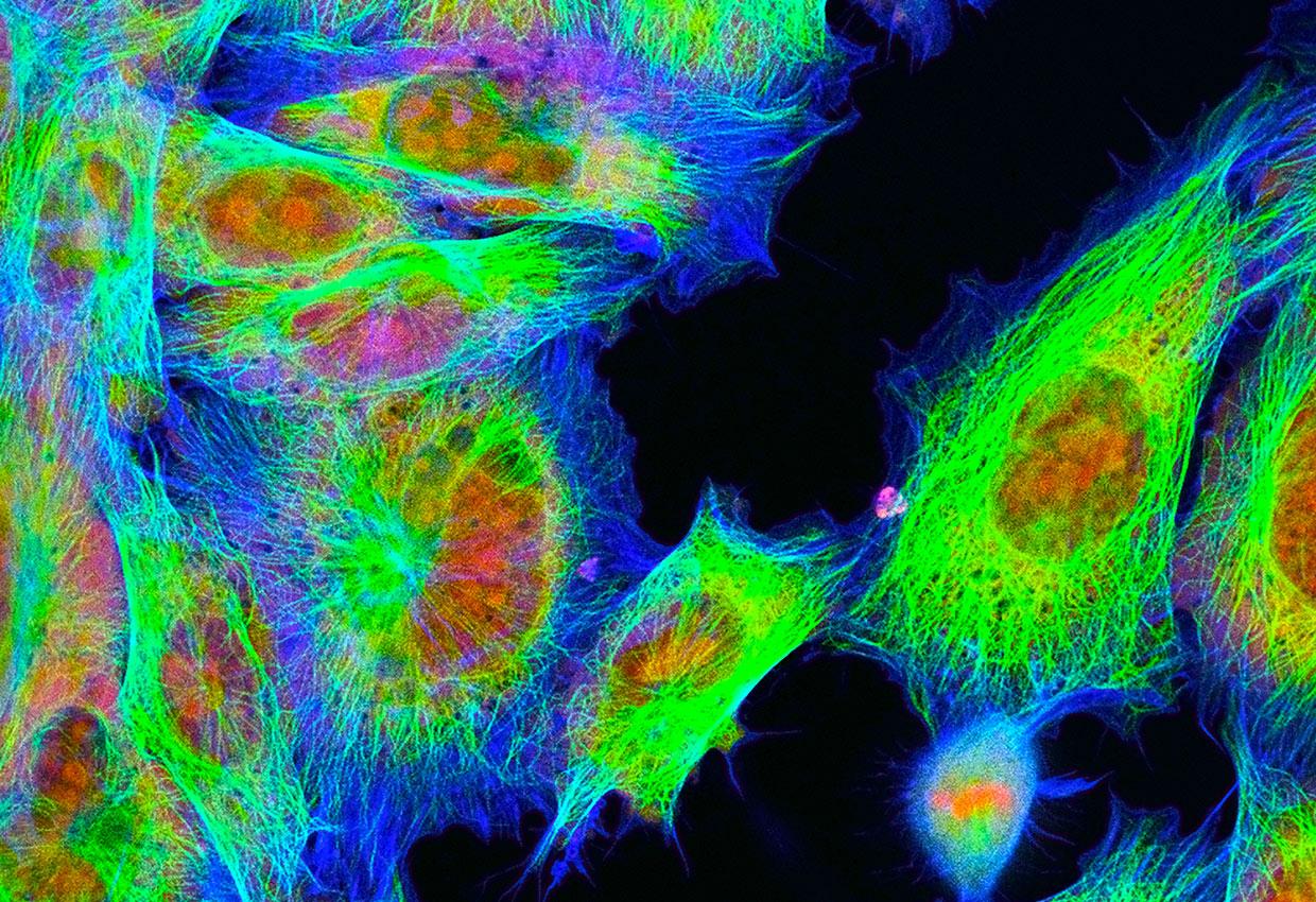 Fluorescence-microscopy