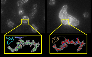 Scientists re-engineer body’s immune system for safer and more effective cancer treatment