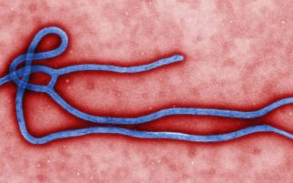 Anticancer drug stops Ebola virus 