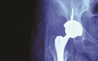 Uncovering the secrets of bone...