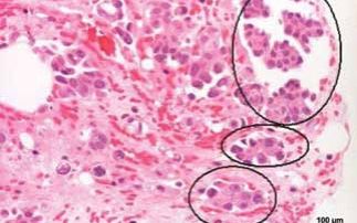 Towards IR fingerprinting of cancer ex vivo: pilot studies on stained cells with micro IR spectroscopy