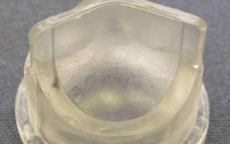 Broken heart valves
