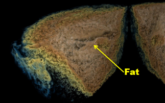 Advanced X-ray imaging using sandpaper