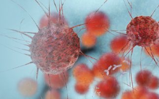 Shining a light on medical diagnostics