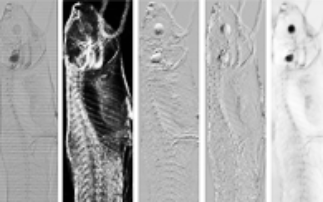 Novel X-ray imaging technique with sandpaper
