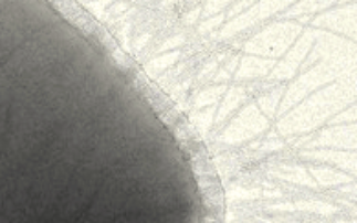 Spring-like bacterial hairs initiate infection