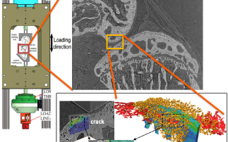 Improved X-ray based technique developed for understanding joint behaviour in world’s most common musculoskeletal condition 