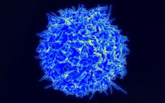 Diamond helps uncover how an untreatable cancer-causing virus affects immune cells 