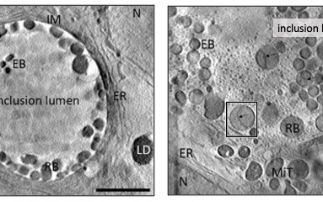 Diamond peers inside cells hosting Chlamydiae bacteria  