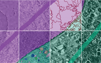 SuRVoS: Speeding up Segmentation of Biological Imaging Volumes