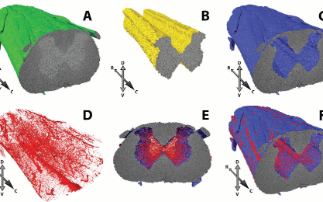 Maximising information from precious biological samples: Combining 3D X-ray imaging with traditional 2D histology