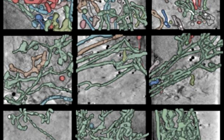 How does the herpes virus hijack our cells? Cryo-SXT can show us…