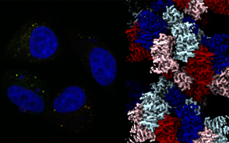 Understanding a protein that fuels bowel cancer