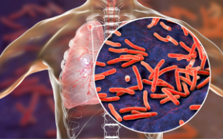 Toxic behaviour: why do tuberculosis bacteria poison themselves? 