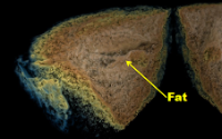 earlier stages of the speckle technique