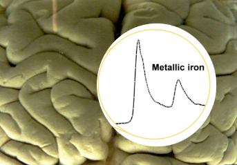 Discovering microscopic metal particles in brain