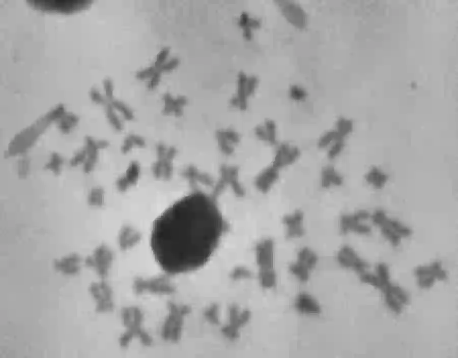 Ptychographic phase image of a human chromosome spread. Sample courtesy of Ian Robinson.