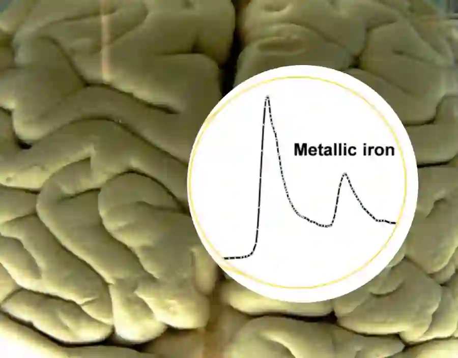 Discovering microscopic metal particles in brain