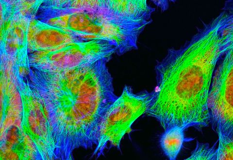 Fluorescence-microscopy