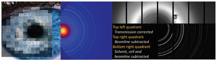 Figure 2: Mapped scan showing the orientation of collagen in a sample overlaid on an image of a human eye (L. Paletto, Albon Group, Cardiff University, UK, Collected October 2017) (left). A gridless Pilatus 2M image gathered from 3 detector frames at differing positions (Y. Zhang and S. Prabakar, New Zealand Leather and Shoe Research Institute, Collected August 2017) (middle). A wide angle X-ray scattering (WAXS) scan highlighting various levels of background subtraction, made possible by applying data corrections before subtraction (Stawski Group, GFZ Centre for Geosciences, Germany, Collected July 2017) (right).