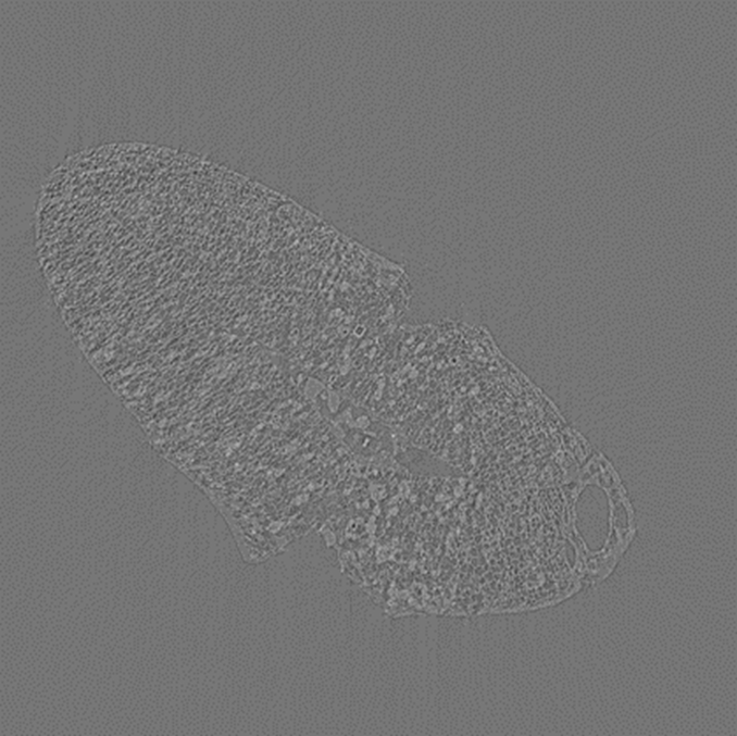 Slice image of horsegram seed