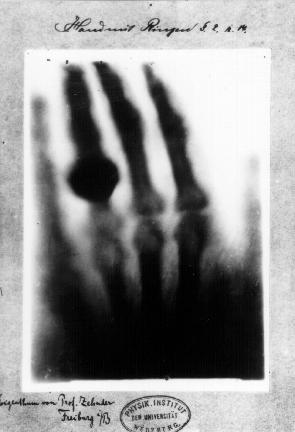 Hand mit Ringen (Hand with Rings): a print of one of the first X-rays by Wilhelm Röntgen (1845–1923) of the left hand of his wife Anna Bertha Ludwig. It was presented to Professor Ludwig Zehnder of the Physik Institut, University of Freiburg, on 1 January 1896.