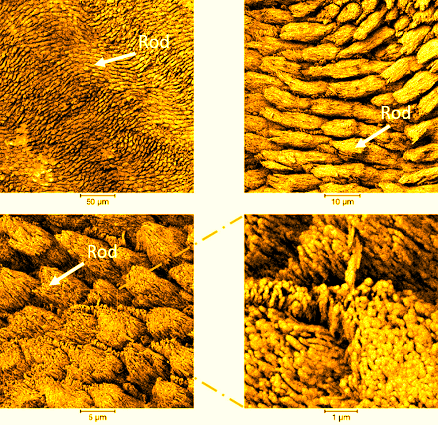 Multiple resolution SEM imaging of carious enamel surface showing the hierarchical structure of rods formed by bundles of hydroxyapatite nanocrystals. <br/>Image: Cyril besnard et al. https://doi.org/10.1016/j.matdes.2021.109739 <br/>