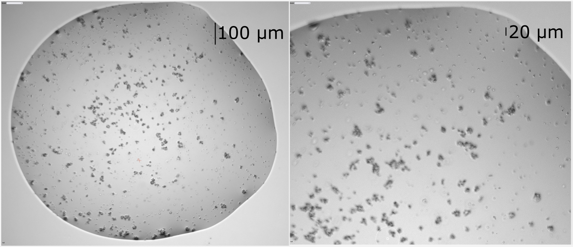 The above sample as scored as microcrystals in VMXi. These were prepared for VMXm and data were collected. A complete dataset at 2.79 Å resolution was assembled from a several smaller datasets collected from multiple crystals. The panel to the right is at maximum zoom in the ISPyB interface.