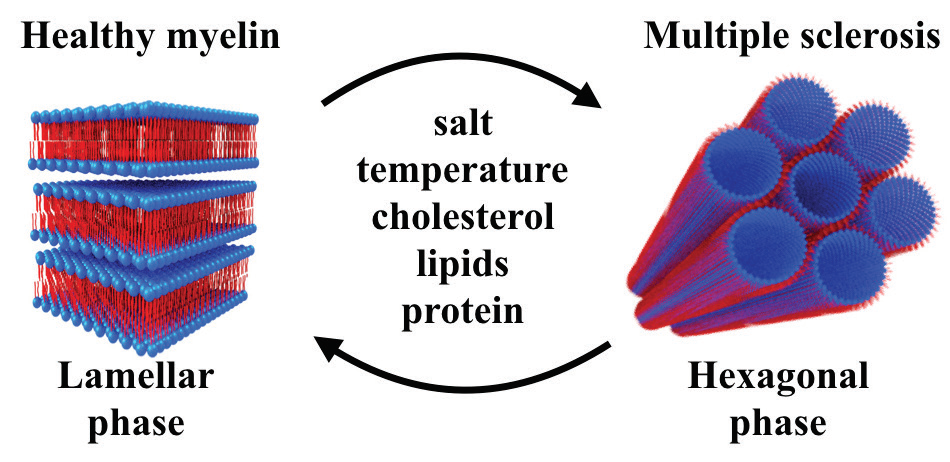 Figure 1: Schematic summary of the conditions resulting in phase transition in healthy and<br/>diseased myelin.