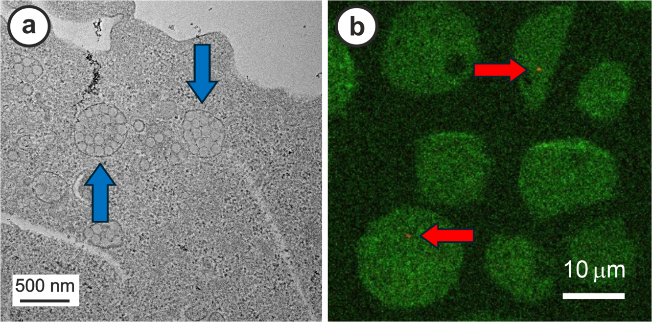 Figure 2. Europium-labelled nanoplastics (Eu-NPs) in macrophage cells by TEM microscopy, inside membrane-bound compartments