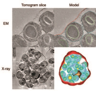 Figure 3: Electron and X-ray tomograms of cells arrested late in egress by E64. Colour code as
<br/>in Figure 2.
