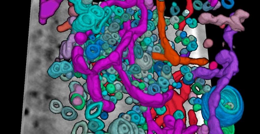 Image Exploring the utility of X-ray tomography for virus research