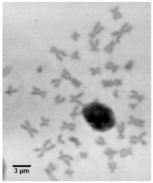 Spread of unstained chromosomes as revealed from a ptychographic phase image. 