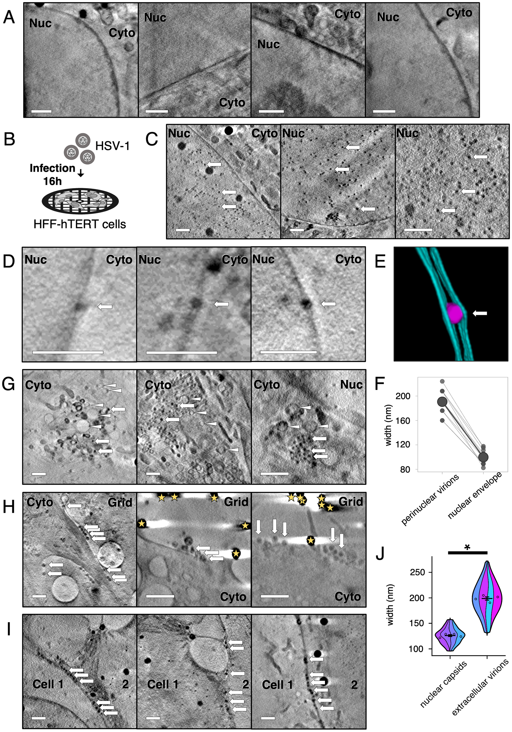 Soft X-ray tomography imaging at cryogenic temperatures of HSV-1-infected HFF-hTERT cells identifies virus particles.<br/>HFF-hTERT cells were grown on EM grids, infected (MOI 2) with HSV-1 or mock-infected, and plunge cryocooled 16 hpi. All tomograms were reconstructed from X-ray projections collected using 25 nm (A) or 40 nm (C, D, G–I) zone plate objectives; scale bars = 1 μm. (A) The nucleus (Nuc) has a largely uniform X-ray absorbance in uninfected HFF-hTERT cells. Cyto, cytoplasm. (B) Schematic of infection workflow. (C) In HSV-1 infected cells many dark puncta are evident in the nucleus, consistent with these puncta being newly assembled HSV-1 capsids. (D) Dark puncta were also observed within the perinuclear space of the nuclear envelope, consistent with these being HSV-1 capsids undergoing primary envelopment/de-envelopment to leave the nuclear space. (E) Segmentation of a perinuclear viral particle (magenta) and the two membranes of the nuclear envelope (cyan). The perinuclear viral particle expands the nuclear envelope. (F) The width of perinuclear viral particles plus associated membranes is 190.5 ± 6.01 nm SEM (N = 11; 20.8 nm SD), which is greater than the width of the nuclear membrane elsewhere (99.8 ± 3.57 nm SEM; N = 11; 11.9 nm SD). (G) HSV-1 capsids (arrows) were also observed in the cytoplasm alongside vesicles (arrowheads). (H) Multiple particles are observed along the surface of infected cells, consistent with these being assembled HSV-1 virions that have exited the infected cell. Gold fiducials are indicated with stars. (I) HSV-1 virions are also observed at the junctions between cells. (J) The width of the nuclear capsids is 125.8 ± 1.70 nm SEM (n = 80 from 4 tomograms), consistent with these being HSV-1 capsids (~125 nm) [38,106]. The width of the extracellular virions is 198.6 ± 3.48 nm SEM (n = 80 from 4 tomograms), consistent with these being fully-enveloped HSV-1 virions (~200 nm) [51]. Due to unequal variance, a Mann-Whitney U test was performed to determine a significant difference in the width of nuclear capsids and extracellular virions (W = 126, p-value<2.2×10−16). Error bars show mean ± SEM.