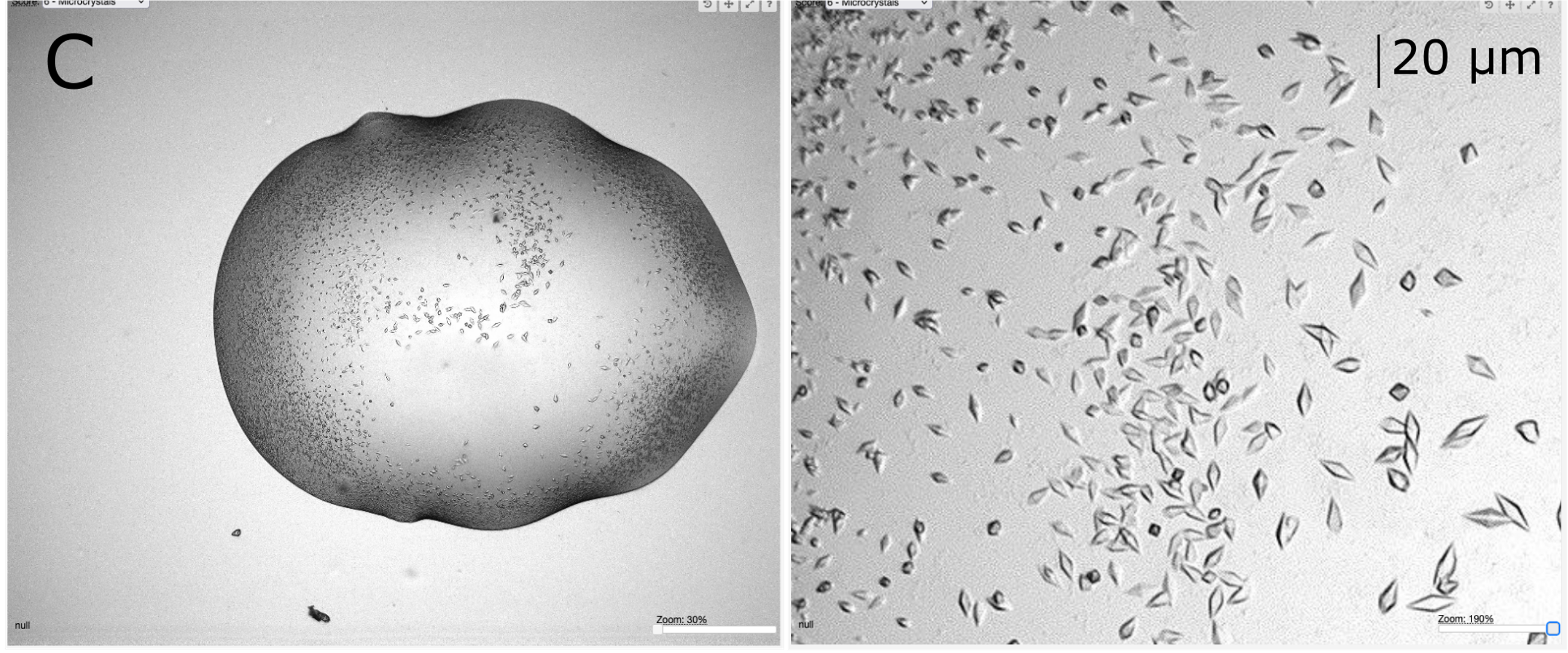 These microcrystals look well formed, however, they only diffracted to 6Å. This was still a useful case as it informed the user they had formed protein crystals and could use this result as a basis for crystal optimisation. The panel to the right is at maximum zoom in the ISPyB interface.