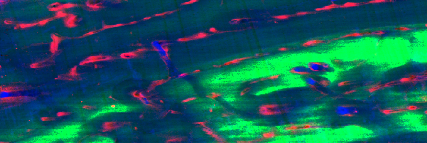 False-coloured XRF map of the samples from Diamond Light Source