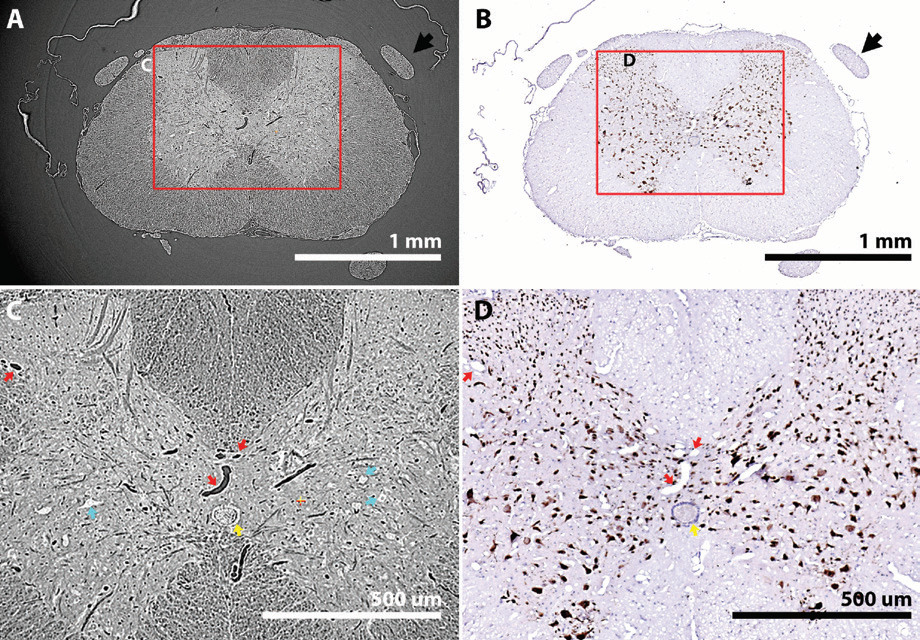 Figure 2: After 3D imaging a spinal cord sample by (a, c) SR-μCT, tissue can be sectioned and<br/>probed by (b, d) 2D histology. Tomography and histology can be aligned by features within<br/>samples including vasculature (red arrows) and the central canal (yellow arrow). Cell bodies<br/>are also apparent (blue arrows). (b, d) Immunolabelling for NeuN (a marker for neuronal cell<br/>bodies) confirms tissue is viable for histology after 3D scanning.