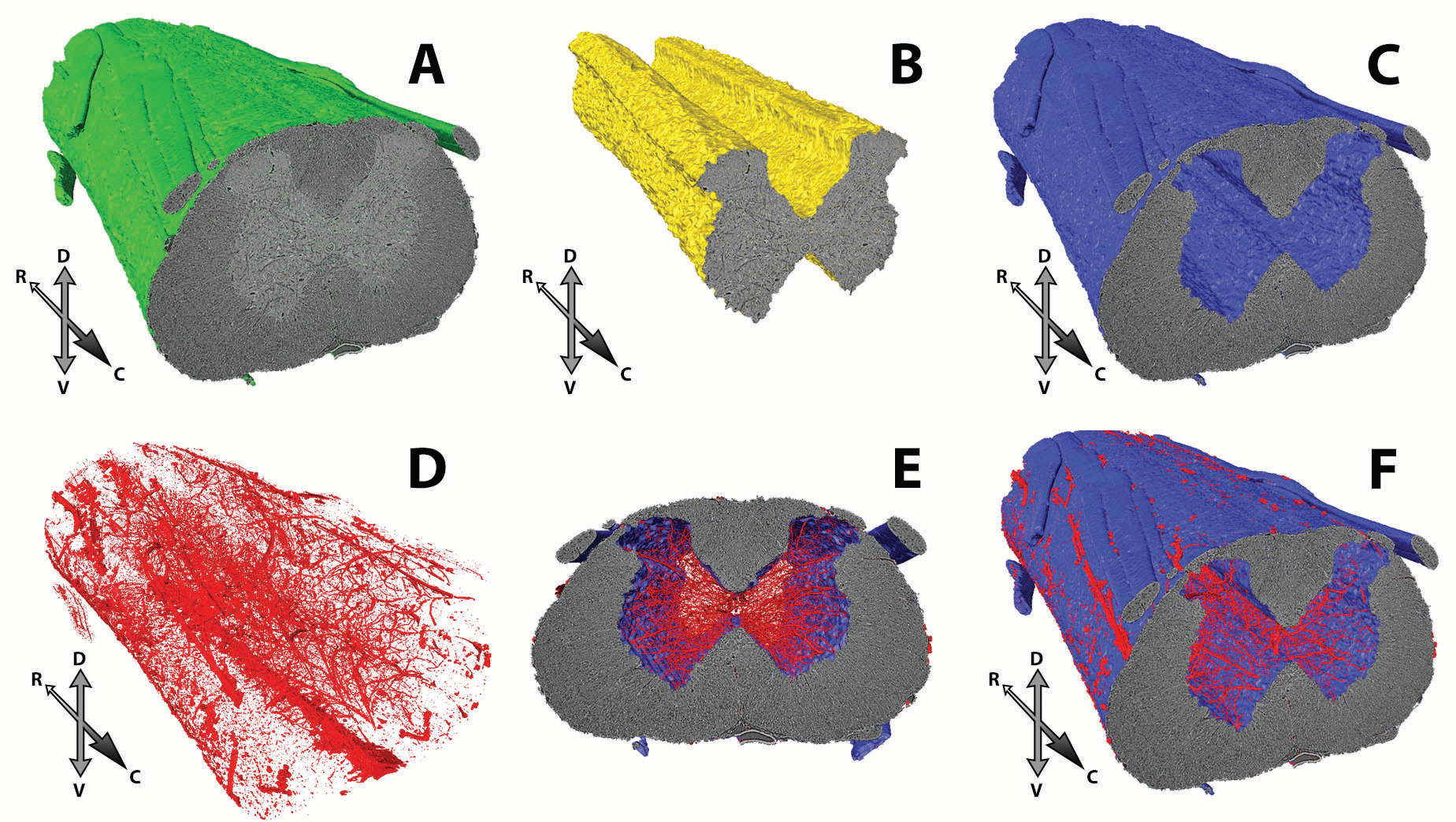 Figure 3: Tomography scans
<br/>can be used to hierarchically
<br/>extract tissue volumes including
<br/>(a) the whole spinal cord, (b)
<br/>grey matter, (c) white matter,
<br/>and (d) spinal cord vasculature
<br/>using the Super-Region Volume
<br/>Segmentation (SuRVoS)
<br/>software developed at Diamond.
<br/>(e, f) Overlay of vasculature and
<br/>white matter volume.