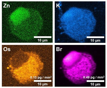 X-ray fluorescence images taken at the I14 beamline at Diamond Light Source, the green is Zinc, Blue is Potassium, Orange is Osmium and Pink is Bromine.