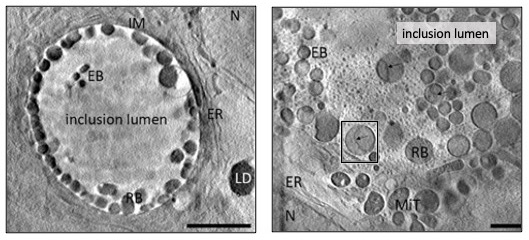 B24 cryo-SXT projection images of areas inside HeLa cells infected by C. trachomatis. These human cells were infected with C. trachomatis and imaged at B24 after 24 hours using either a 40 nm objective (panel on the left) or 25 nm objective (E) (the field of view decreases as image resolution decreases). The left panel captures a whole inclusion with resident bacteria attached on the inside surface (dark roughly circular shapes). The right panel shows an area of the interior of an inclusion with a variable bacterial population. <br/><br/>Mit: mitochondria, N: nucleus, EB: elementary body, RB: reticulate, IM: inclusion membrane, ER: endoplasmic reticulum body, LD: lipid droplets, black arrow: inner bacterial membrane invagination. 