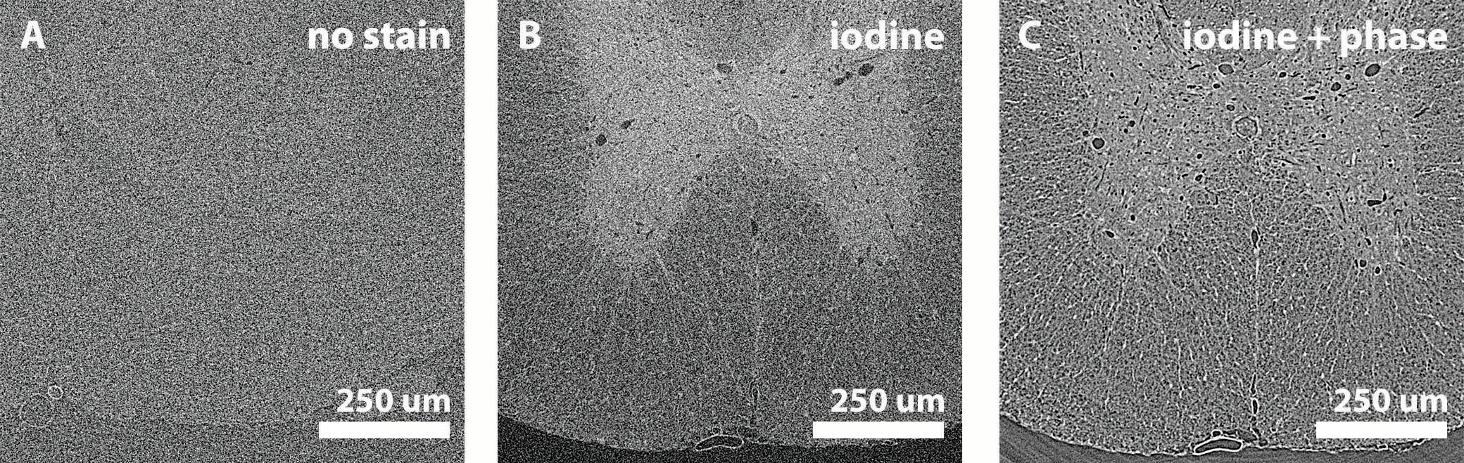 Figure 1: X-ray
<br/>tomography of (a)
<br/>unstained paraffin
<br/>wax embed rat spinal
<br/>cords with contrast
<br/>improvements achieved
<br/>by (b) iodine tissue stain,
<br/>and further improved by
<br/>(c) combining iodine stain
<br/>with optimised in-line
<br/>phase contrast.