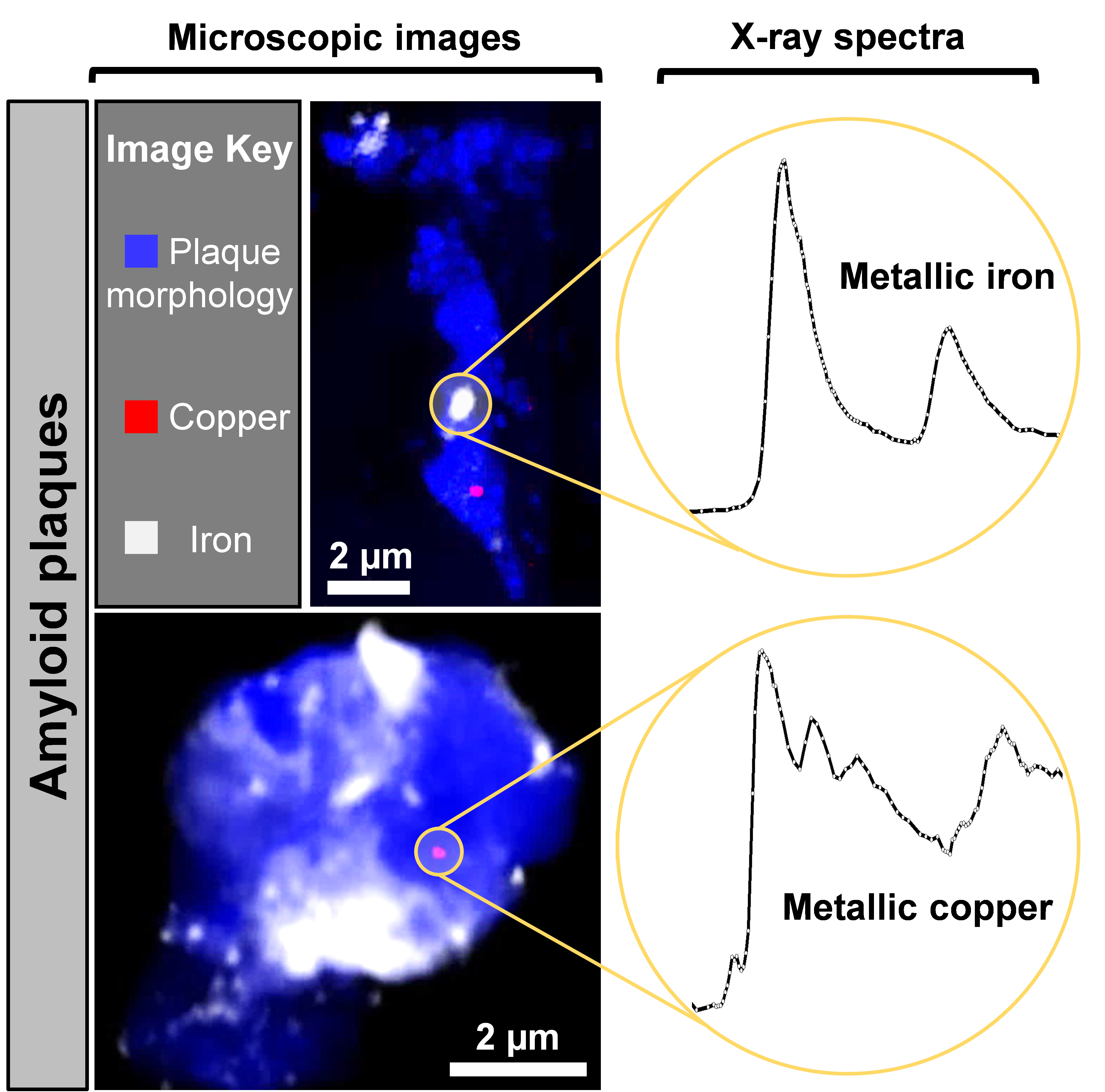 X-ray microscope images and X-ray absorption spectra obtained from two Alzheimer's disease plaque cores, measured at Diamond's beamline I08. Image: Science Advances.