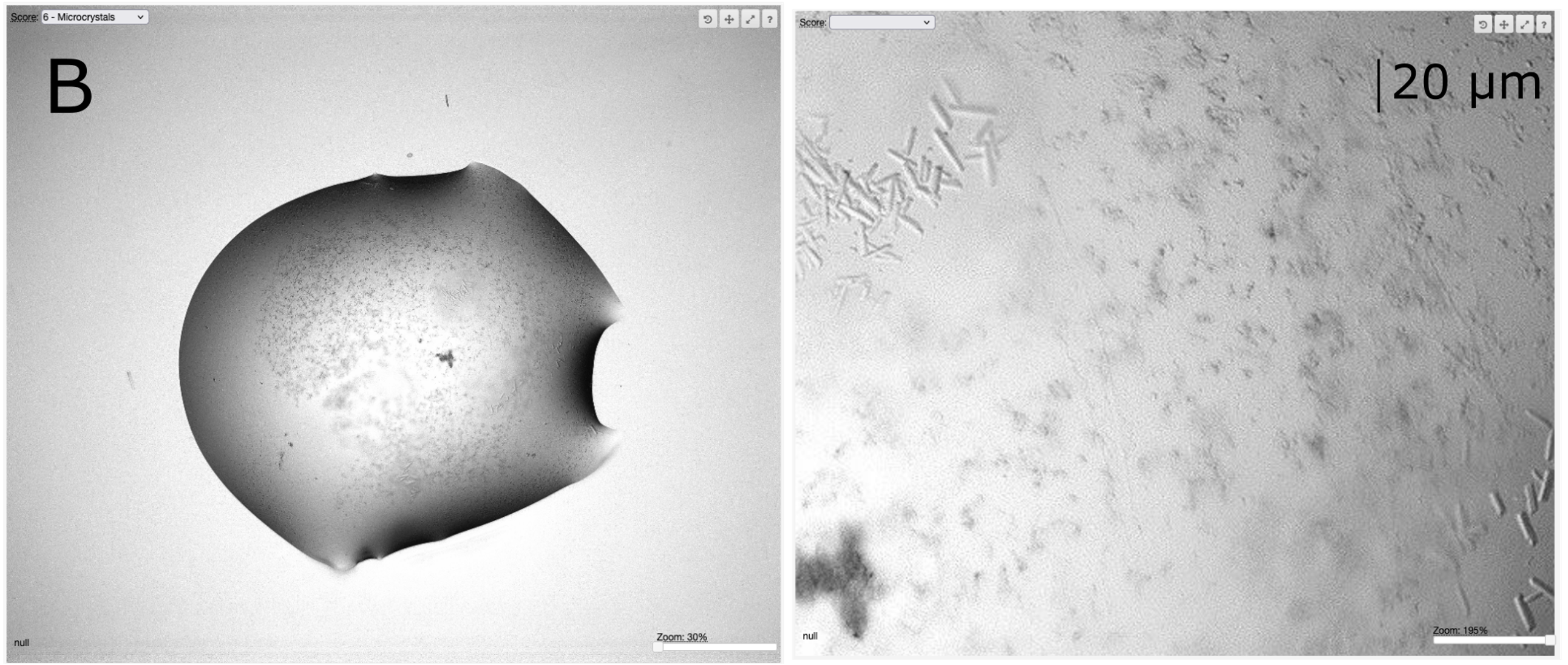 Microcrystals of a new structure identified in VMXi plates. These needles too small for VMXi, are ideal for VMXm. This example diffraction to 2.1Å. The panel to the right is at maximum zoom in the ISPyB interface.
