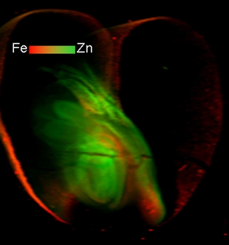Iron (Fe) and zinc (Zn) distributions in wheat grain sections. Copyright Dr Neal, Rothamsted Research