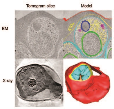 Figure 2: Electron and X-ray tomograms of cells arrested early in egress by Compound 1 or 2.
<br/>Red cell membrane, red; vacuole membrane, yellow; parasite cell membranes, cyan. Other
<br/>colours, parasite organelles and ribosomes.